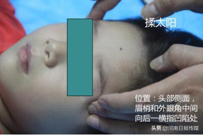 “疫”线中医｜中医外治疗法在治疗新冠肺炎中的应用