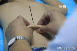 “疫”线中医｜中医外治疗法在治疗新冠肺炎中的应用