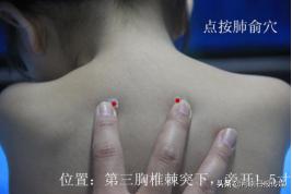 “疫”线中医｜中医外治疗法在治疗新冠肺炎中的应用